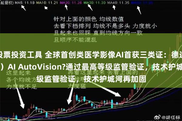 股票投资工具 全球首创类医学影像AI首获三类证：德适（02526）AI AutoVision?通过最高等级监管验证，技术护城河再加固